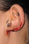 Ear Shaping-3.jpg