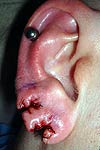 Ear Shaping-4.jpg