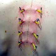 Surface Piercing Rejection-9.jpg