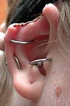 Ear Shaping-2.jpg