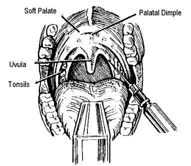 Uvula.gif