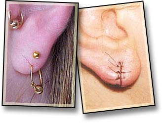 Cheese-cutter Effect-1.jpg