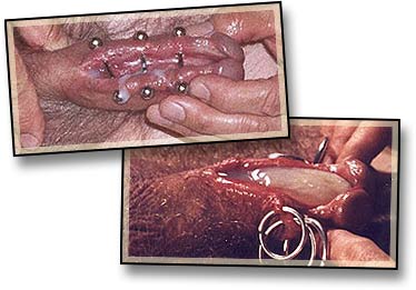 Reduced Ejaculatory Distance-1.jpg