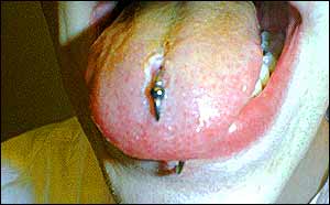 Tongue Orbital-1.jpg