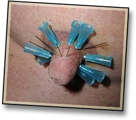 Enlarged Nipples-1.jpg