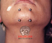 Chinpiercing2.jpg