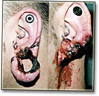 Earlobe Circulation-1.jpg
