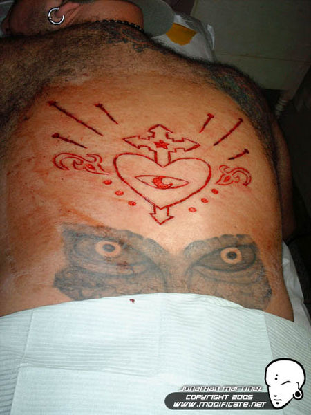 File:Largescarification.jpg