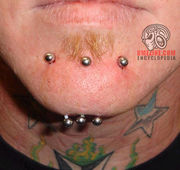 Chinpiercing1.jpg