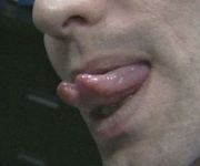TongueSplitting.jpg